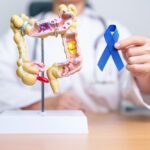 腸活の秘訣！健康的な腸を作るための5つのポイント